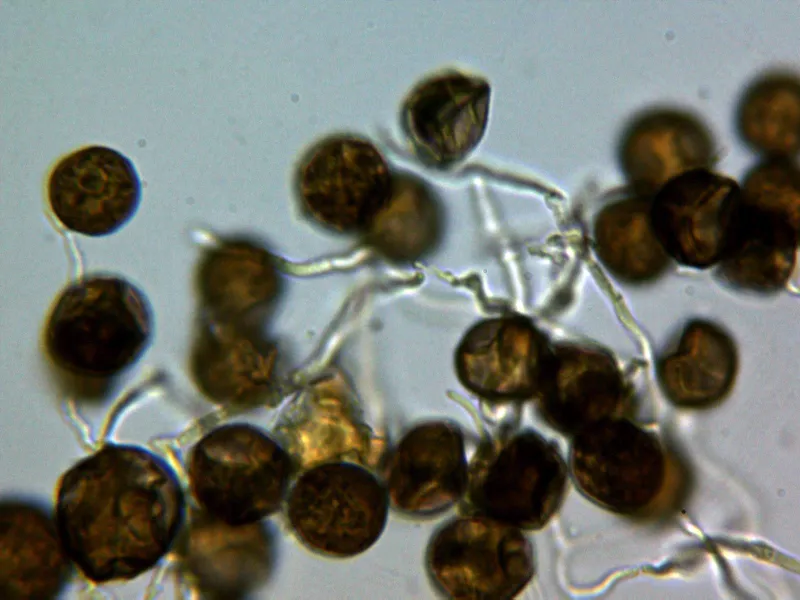 Badhamia affinis 10 - Capilicio hialino Melzer